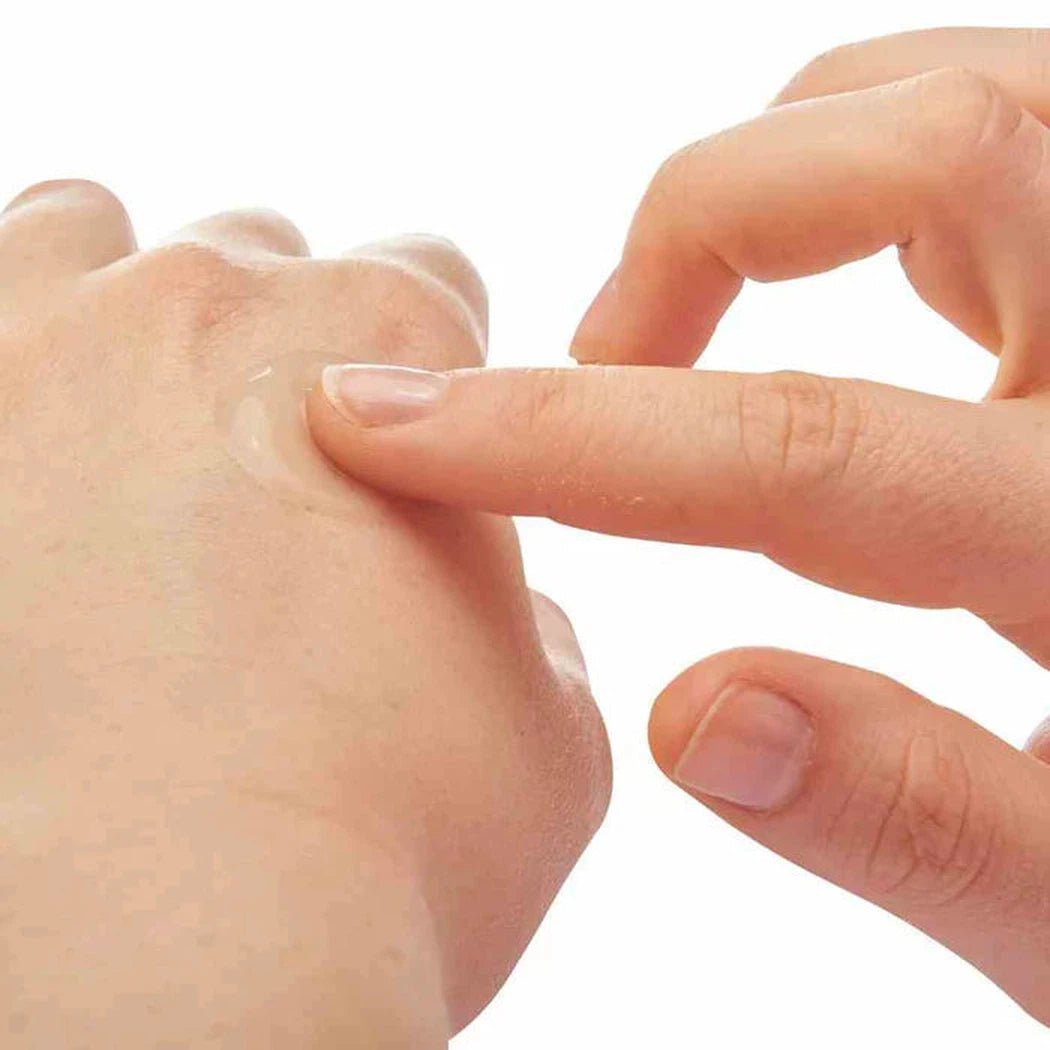 A hand applies the Adventure Medical Kits After Bite Xtra cream to another hand, showing the product in use against a plain white background.